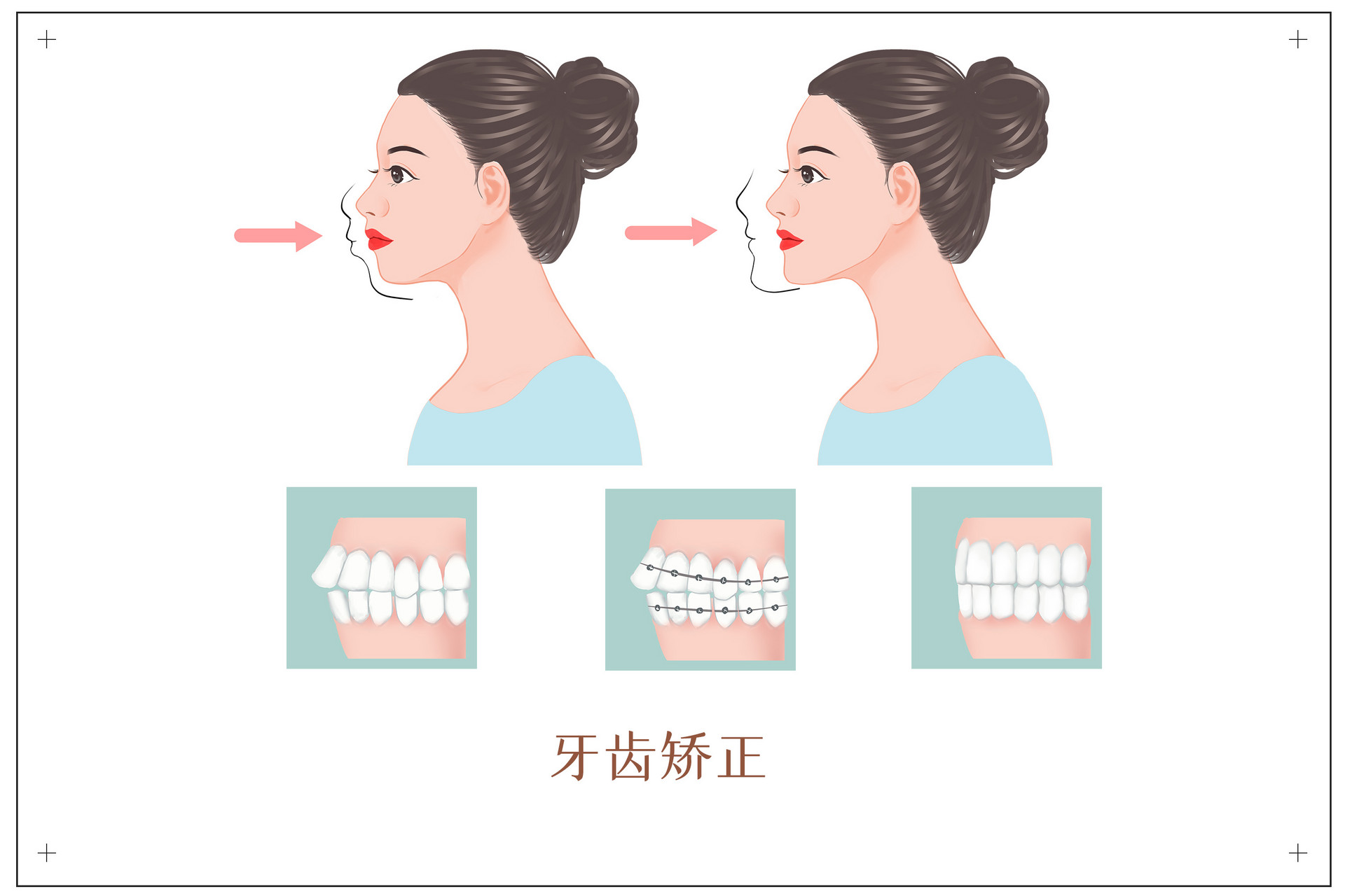 矫正效果.jpg